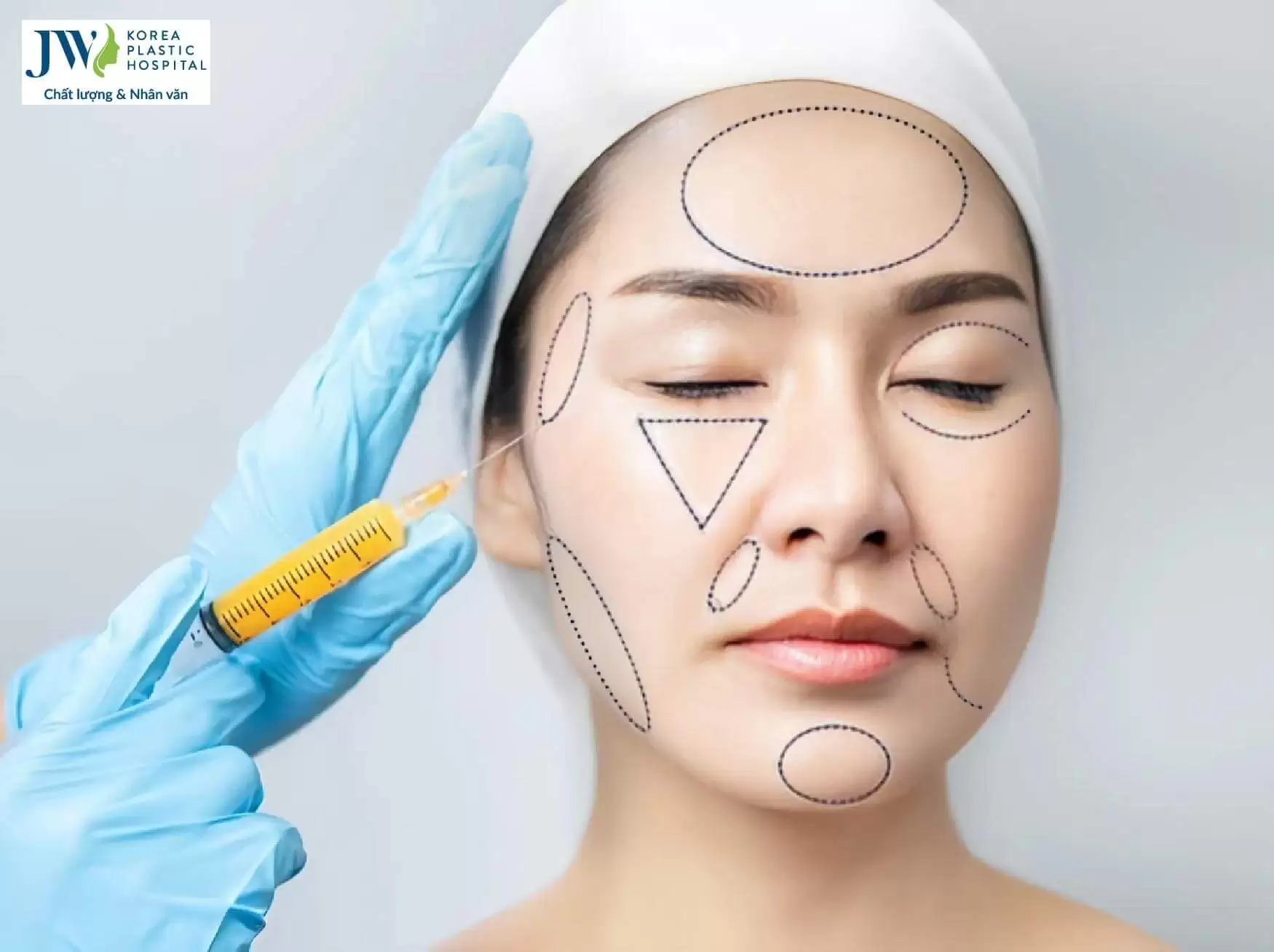 Cấy mỡ thẩm mỹ